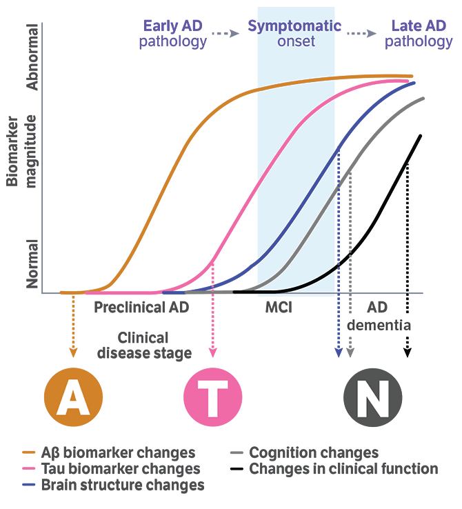 Timeline showing amyloid and tau biomarker buildup years before Alzheimer’s symptoms appear.