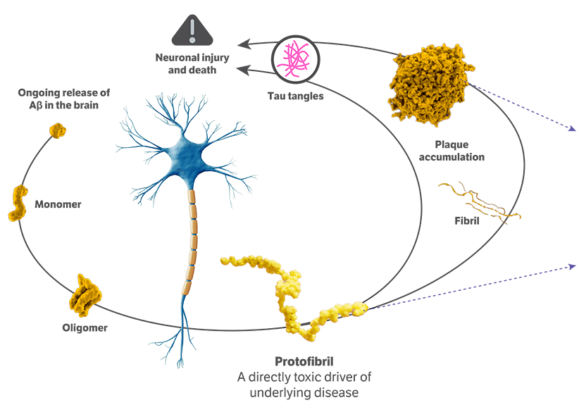 Infographic showing how LEQEMBI clears amyloid plaque and protofibrils to slow Alzheimer’s progression.